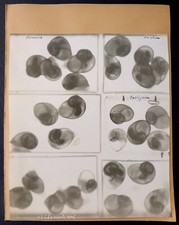 Radiographie X Ray - Escargots