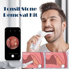 Electronic Visible Tonsil