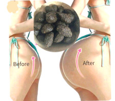 KIGELIA SUPPOSITOIRE VOLUME