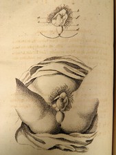 ARNAUD Mémoires Chirurgie