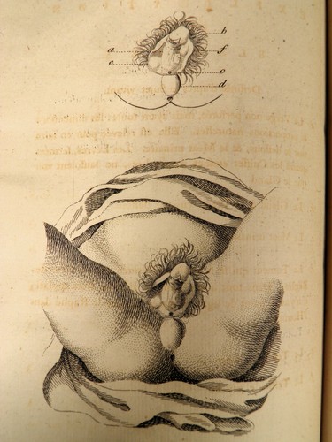Arnaud mémoires chirurgie - arnaud,