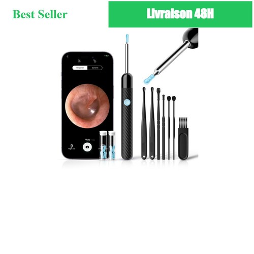 Otoscope oreille 1080p - otoscope,