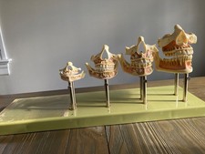 Somso ES14 Dental Development