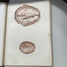 Anatomie écorché,gravure