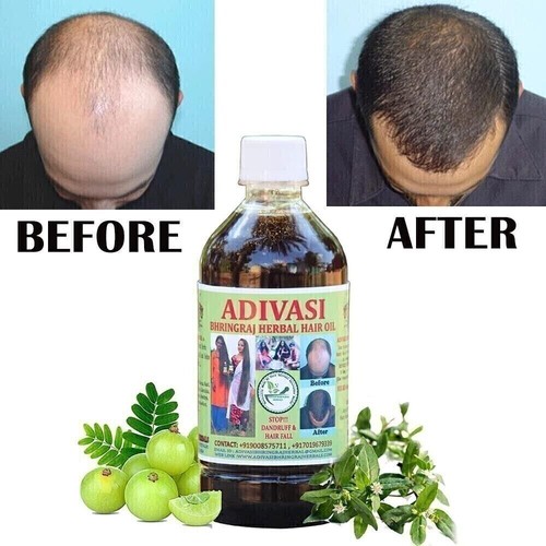 Huile perte cheveux - de,
