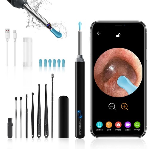 Otoscope oreille 1080p - 1080p,