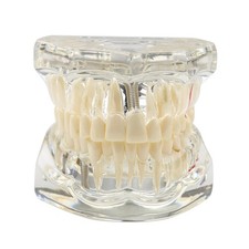 Modèle dentaire transparent