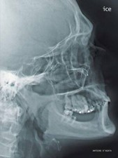 ANTOINE D'AGATA- ICE - Ed