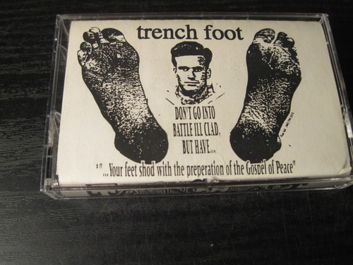 Trench foot subway your - trench,