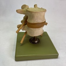 Somso QS68 Anatomical Model