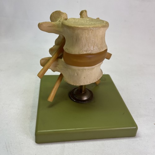 Somso qs68 anatomical model - somso,