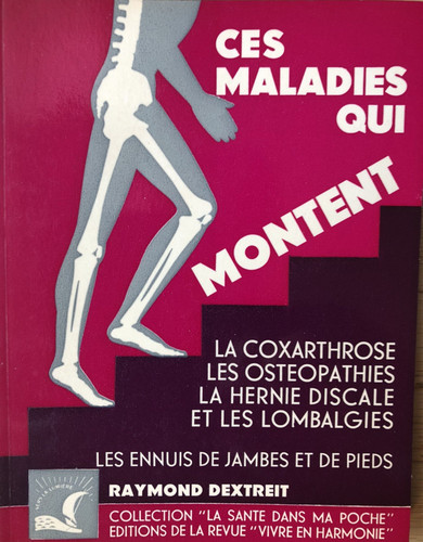 Coxarthrose ostéopathies - coxarthrose,