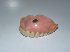 Ancien dentier prothèse