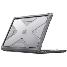 Coque Compatible avec MacBook
