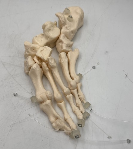 Somso foot skeleton - somso,