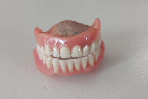Dentier prothèse dentaire - prothèse,