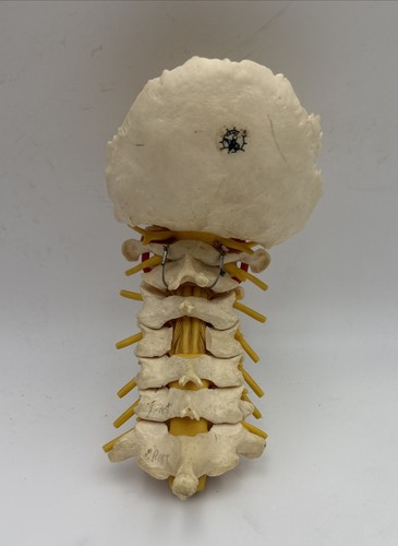 Somso qs65 cervical vertebral - cervical,