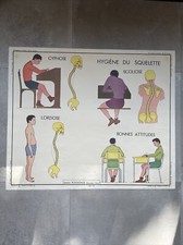 Ancienne affiche ROSSIGNOL corps humain 13/ 14 Cyphose scoliose & Les muscles