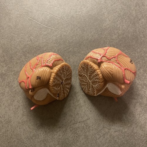 Somso base head cranium brain - cranium,