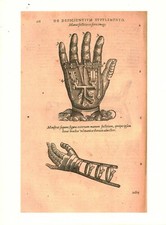 Cabinet de curiosité planche affiche A3 anatomie humaine prothèse de main 