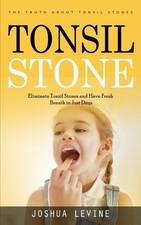 Joshua Levine Tonsil Stones