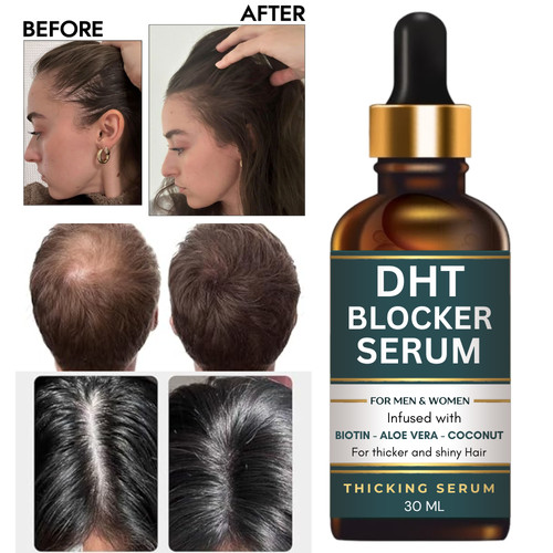 Dht bloqueur sérum - dht,