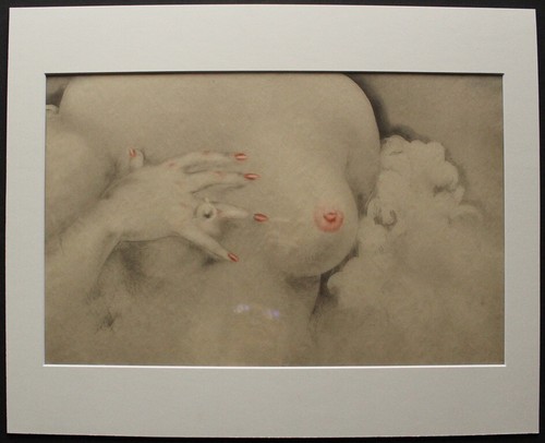 Louis icart aréole - louis, "aréole