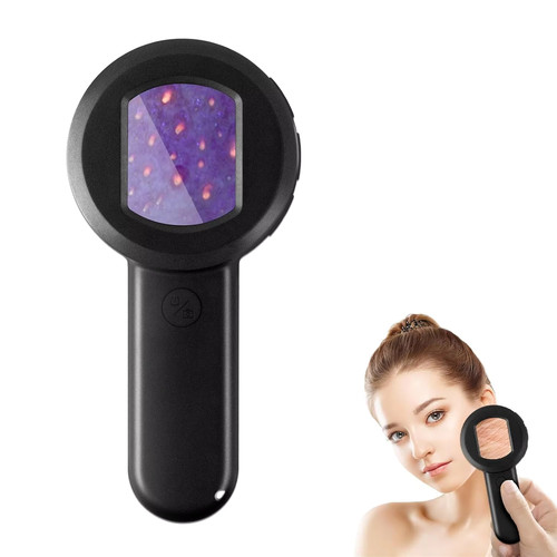Handheld dermatoscope 100x - handheld, dermatoscope,100x
