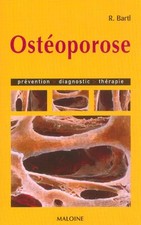 Ostéoporose: Prévention
