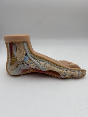 Somso ns1 normal foot - normal,