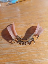 Dentier Prothèse Dentaire