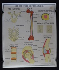 OS ARTICULATION ACCIDENT
