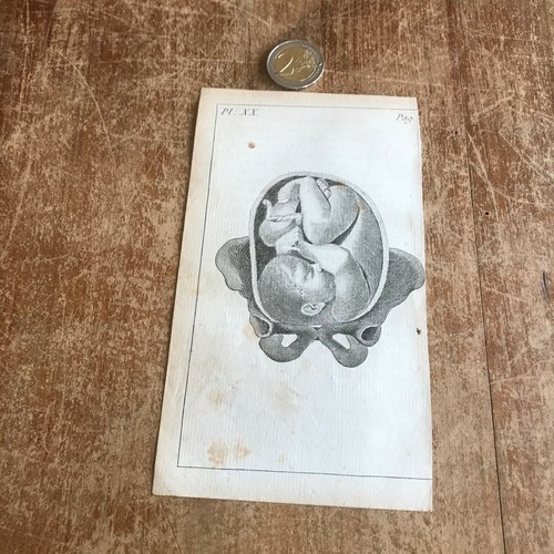 Ancienne gravure anatomie n103 - ancienne,