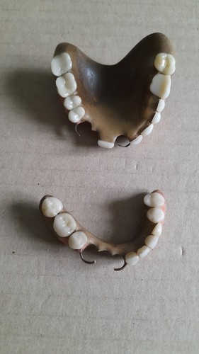 Ancien dentier fausses dents - dentier,,
