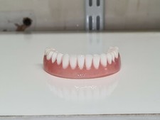 Prothèse inférieure