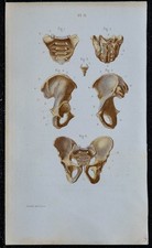 1852 - Planche anatomie Ostéologie : Bassin sacrum coccyx os iliaque - Médecine