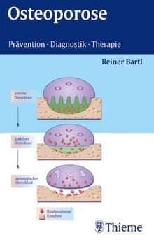 Osteoporose