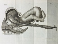 Médecine Obstétrique 1807