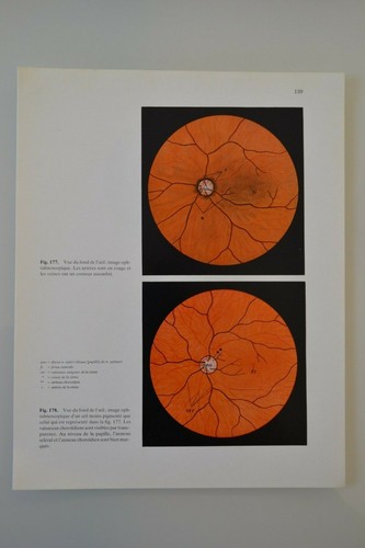Planche anatomie humaine - planche,