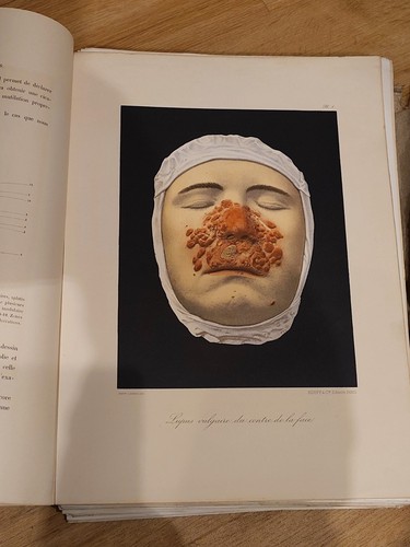 Rare musée l hôpital - rare,,