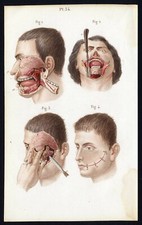 Cabinet curiosité planche