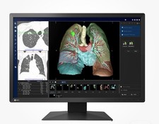 EIZO RadiForce MX243W Medical 24,1" écran large écran LCD moniteur 2,3MP ⭐NEUF⭐