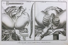 Gynécologue en 1779 Chirurgie