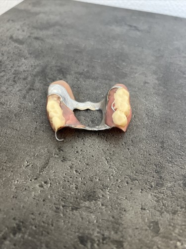 Ancien dentier dent arriere - dentier,