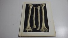 1850.lithographie couleur os