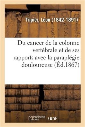 Cancer la colonne - de,