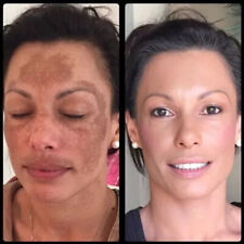 MEDERMA ADVANCED PLUS GEL CICATRICE POUR CICATRICES ET MARQUES - No1 -...