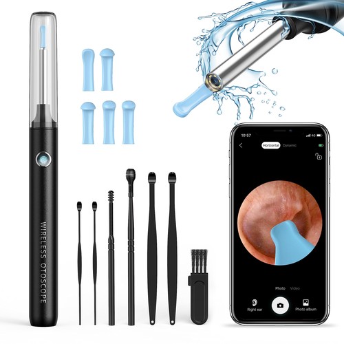 Otoscope oreille 1080p camera - otoscope,