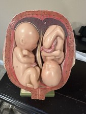 3 Vintage Somso Womb/Uterus