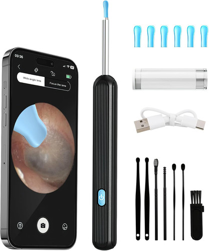 Otoscope oreille 1080p - otoscope, hd